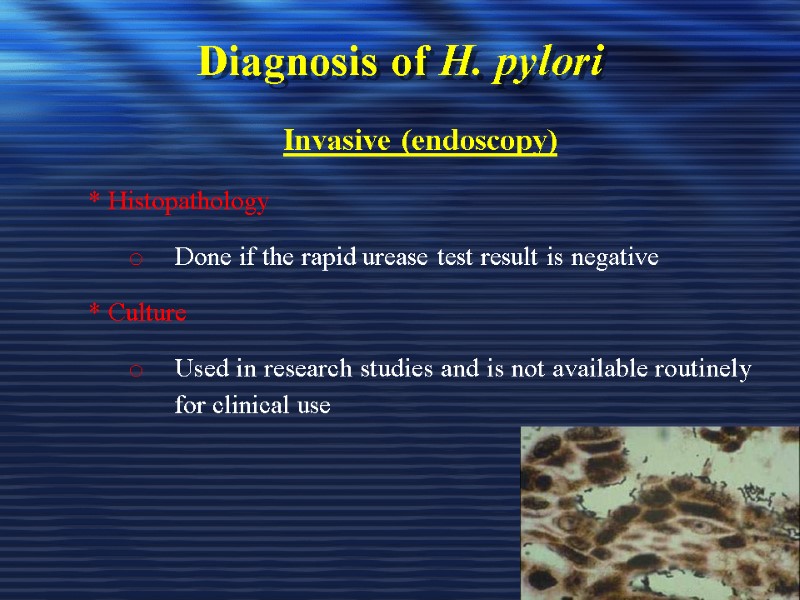 Diagnosis of H. pylori Invasive (endoscopy) * Histopathology Done if the rapid urease test